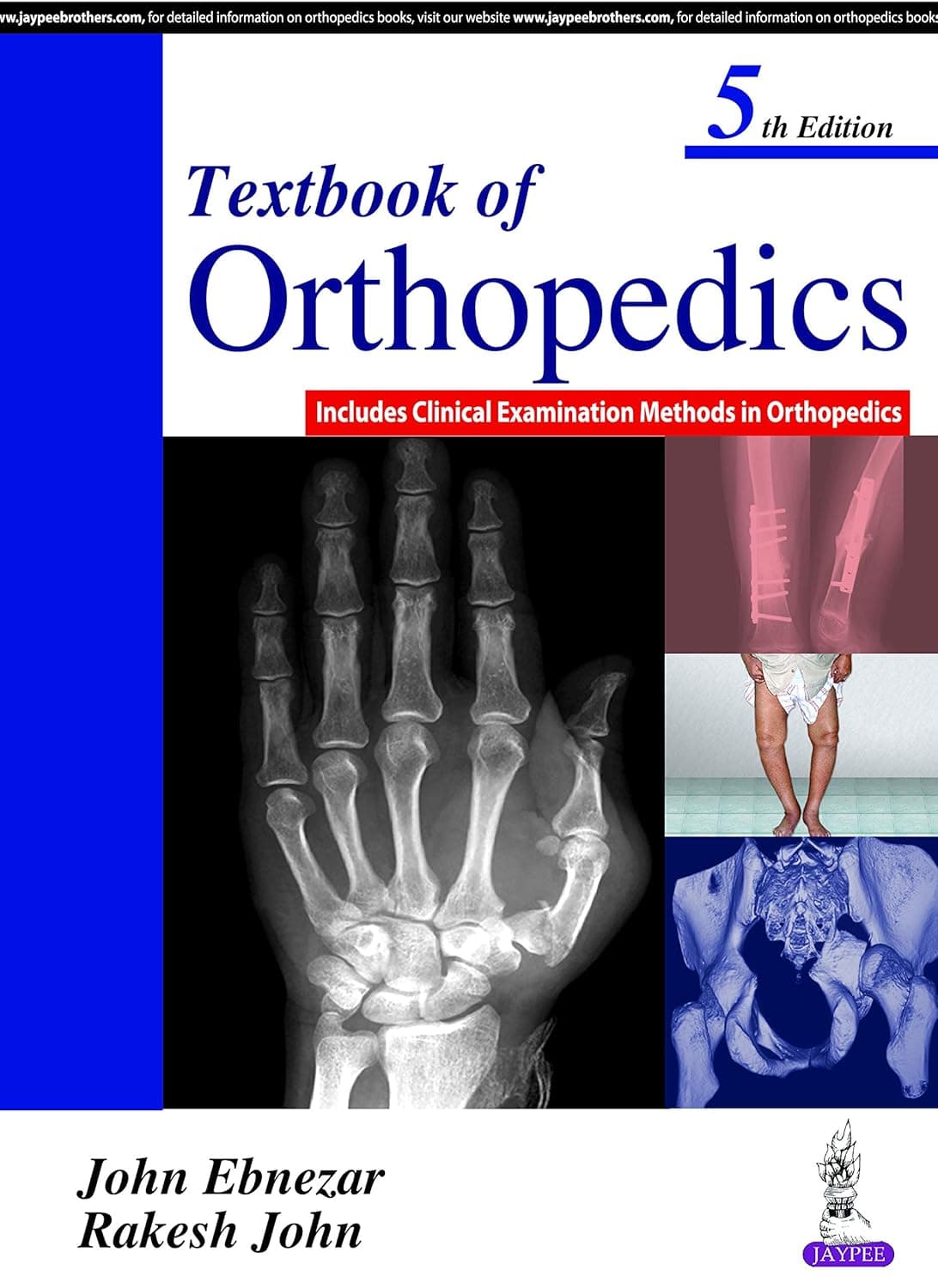 Textbook of Orthopedics: Includes Clinical Examination Methods in Orthopedics