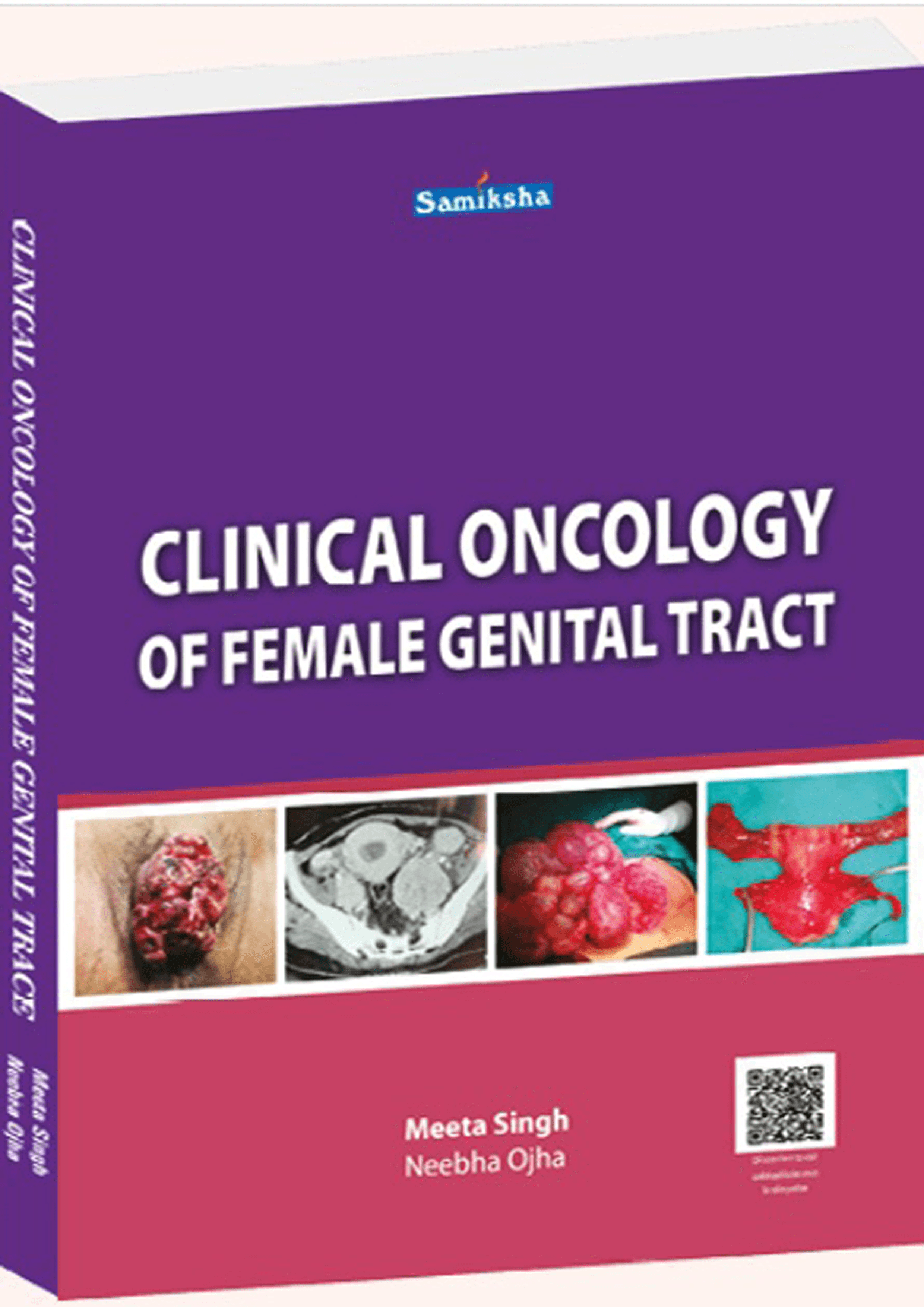 Clinical Oncology of Female Genital Tract